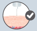 no_pinch_up_0.png