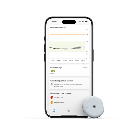 Resimde SmartGuide aplikatörü, Accu-Chek CGM çözümü ve SmartGuide uygulama ekranı gösterilmektedir.