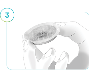 Ciltten çıkarılmış SmartGuide CGM'i gösteren resim.