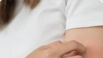 Tahrişi tedavi etmek için cilt bakımı: CGM ve insülin pompası kullanılırken gelişen cilt reaksiyonları için faydalı ipuçları.